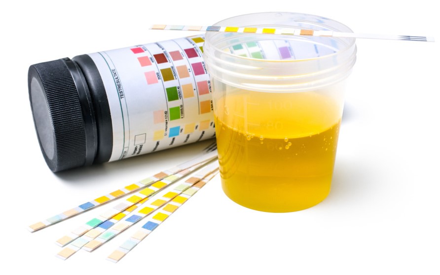 Synthetic Urine Extreme Sherman Avenue Springfield MO